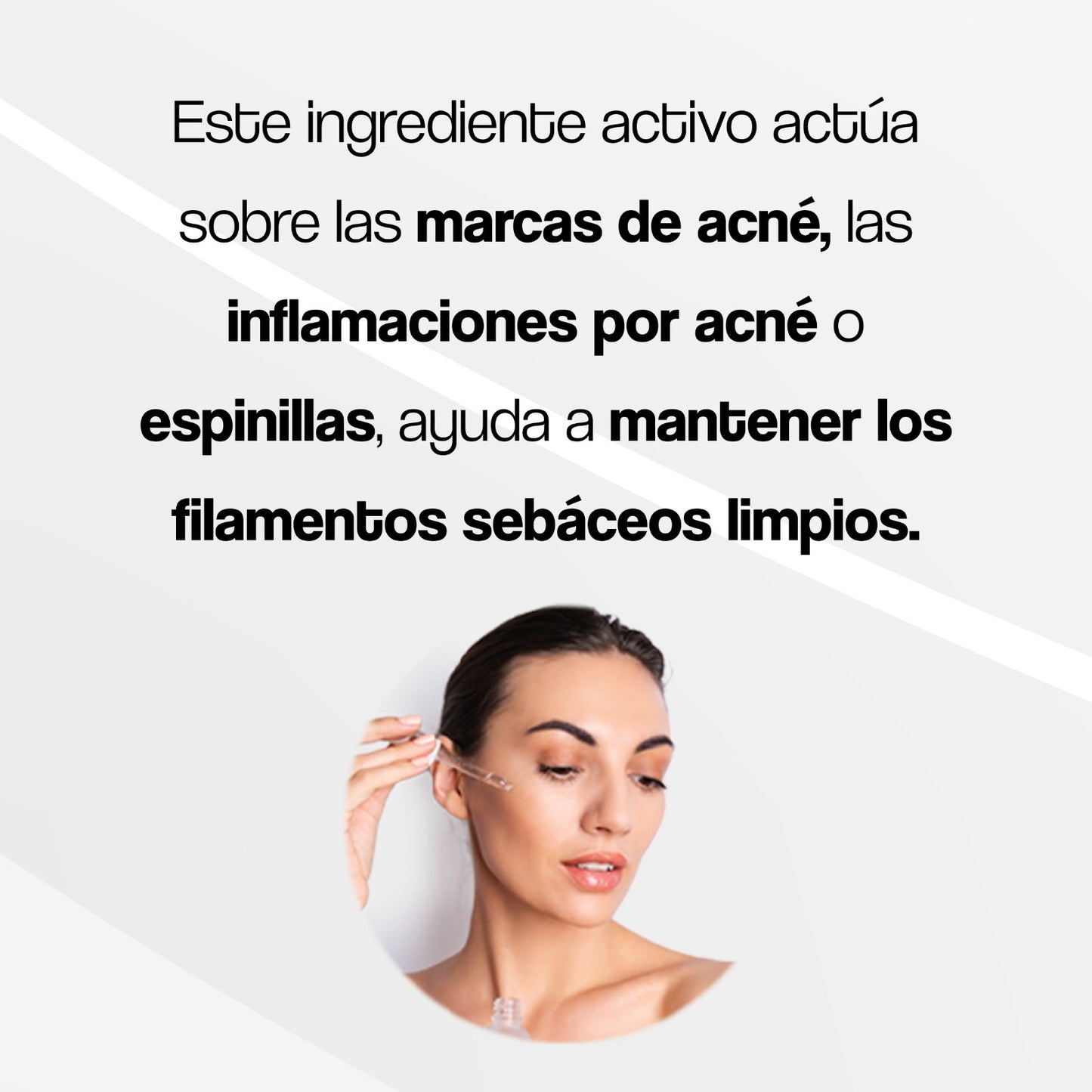 Serum10™: Serum Anti Acné Ultra Concentrado con Ácido Salicílico + 36 Parches Anti-Acné